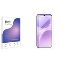 Blue Light Blocking Screen Protector for Vivo V70 Elite.