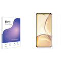 Blue Light Blocking Screen Protector for realme Note 70T.