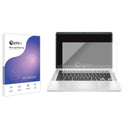 Blue Light Blocking Screen Protector for HP 14a-na1000.